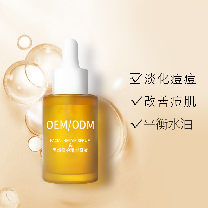 舟山市_祛痘精华原液OEM